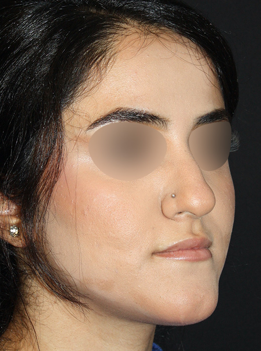 Patient 69 Before Image