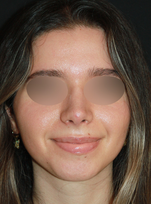 Patient 71 After Image