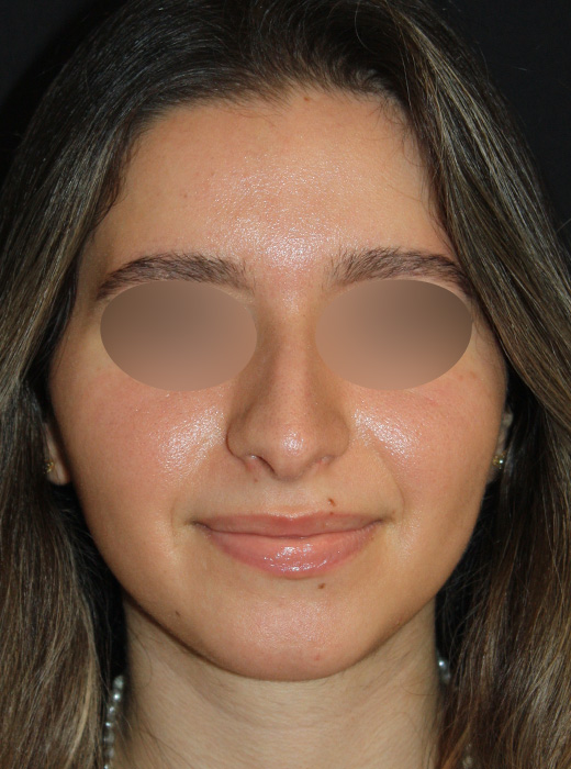 Patient 71 Before Image