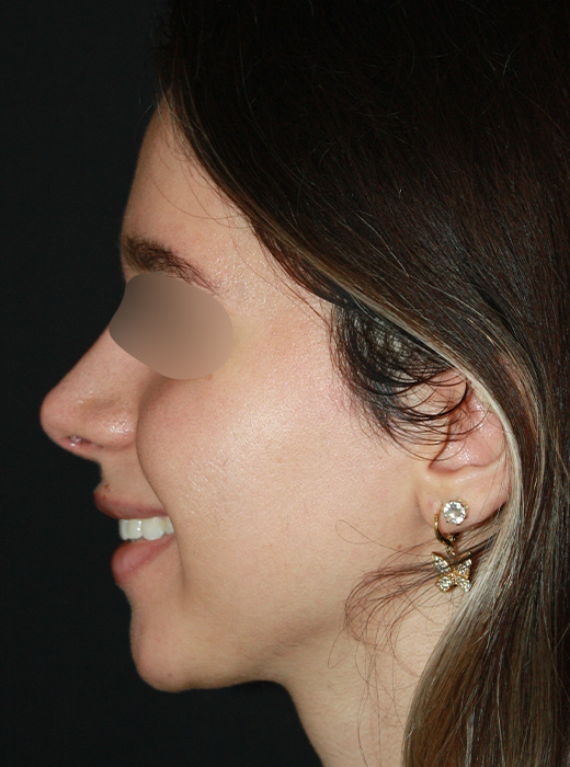 Patient 71 After Image