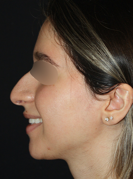 Patient 71 Before Image