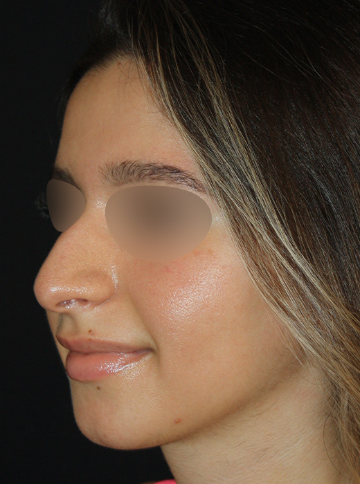 Patient 71 Before Image