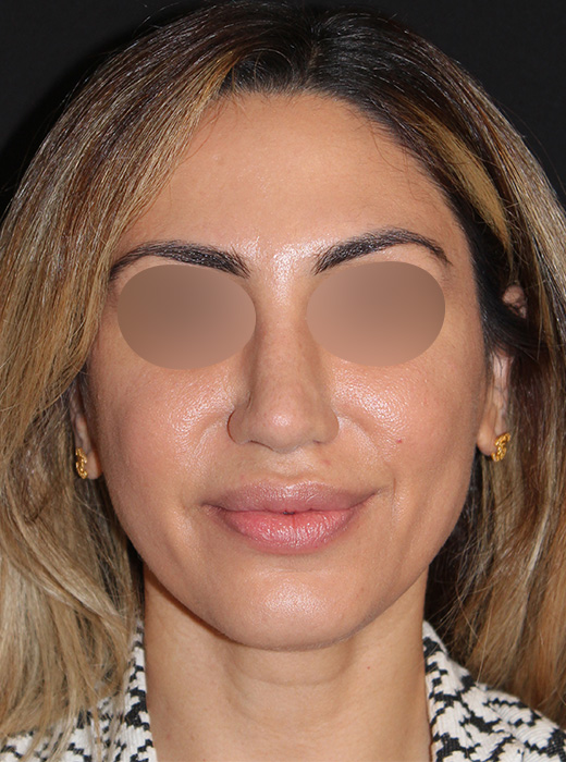 Patient 73 After Image