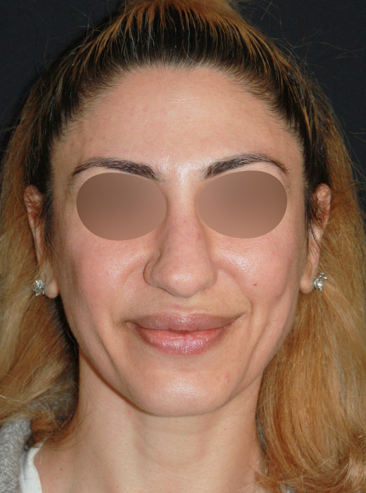 Patient 73 Before Image