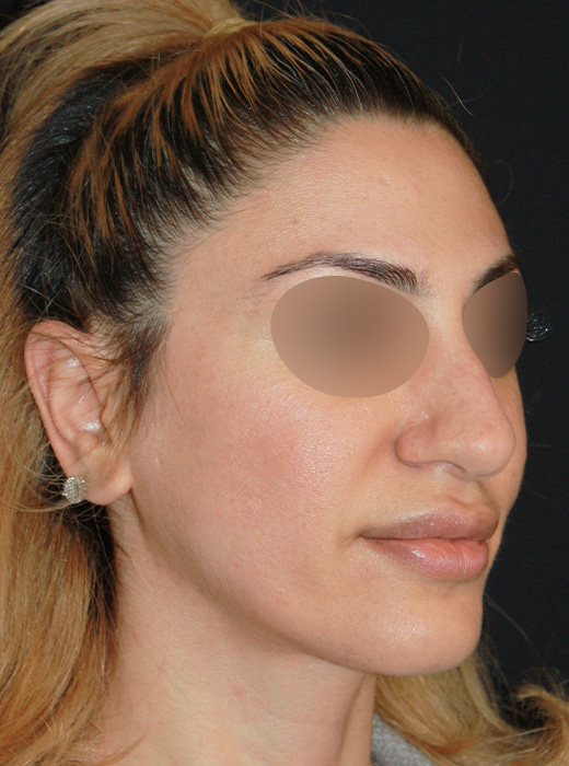 Patient 73 Before Image