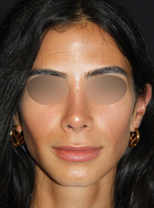 Patient 70 After Image