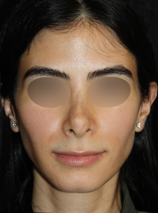 Patient 70 Before Image