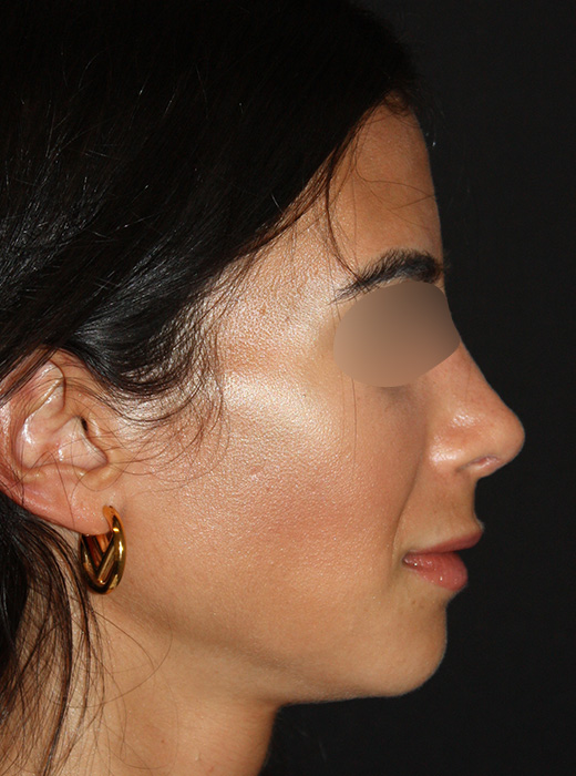 Patient 70 After Image