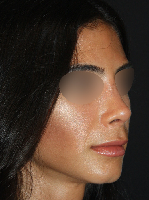 Patient 70 After Image