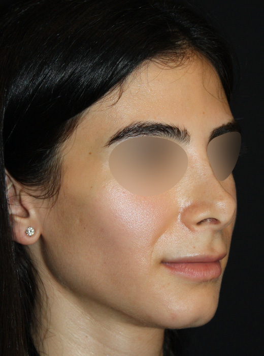 Patient 70 Before Image