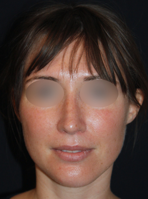 Patient 61 After Image