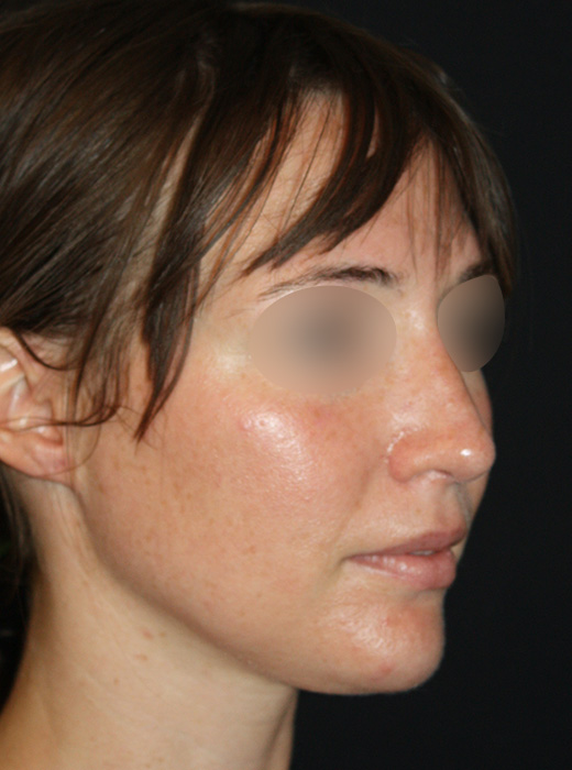 Patient 61 After Image