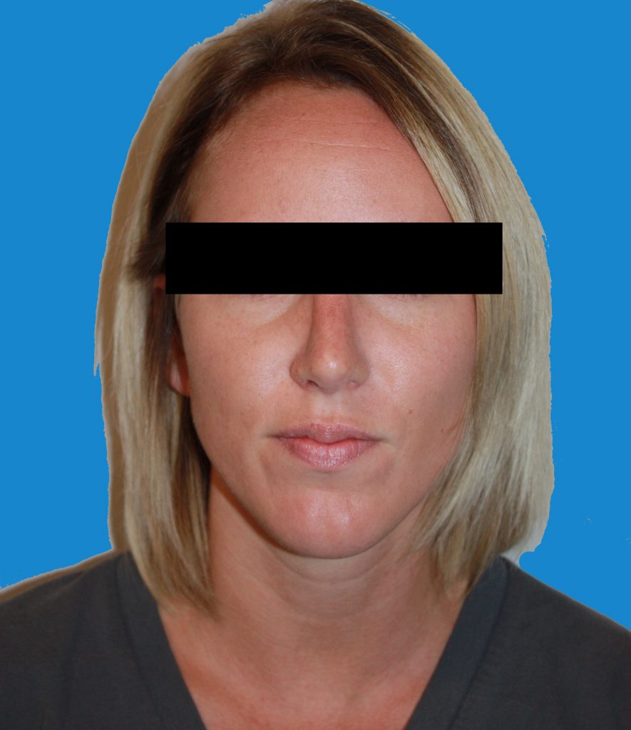 Patient 8 After Image