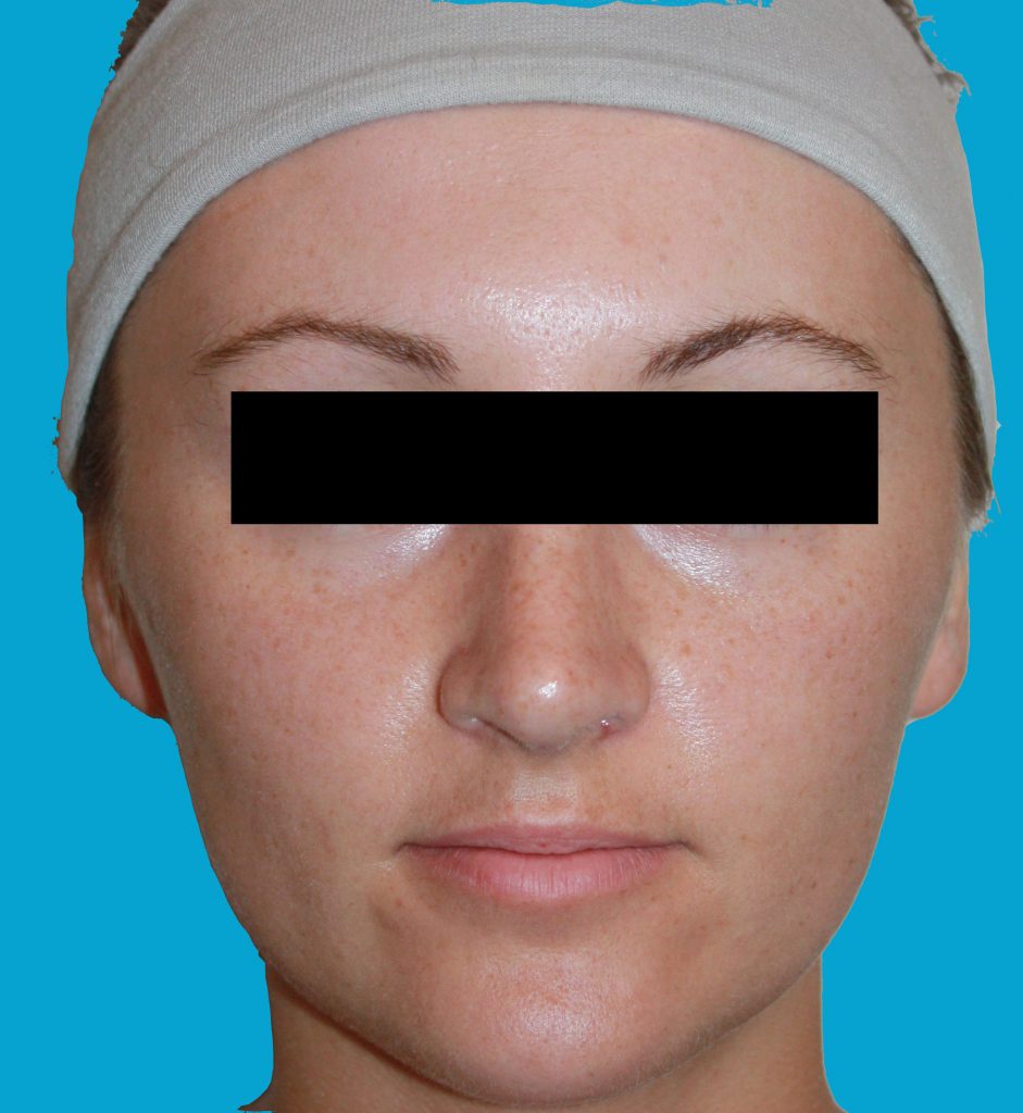 Patient 7 After Image