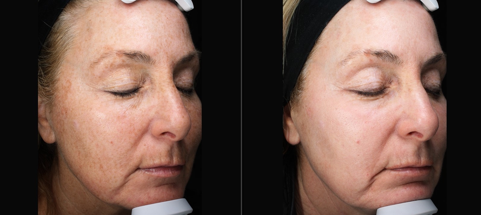 Patient #143 Marge Image