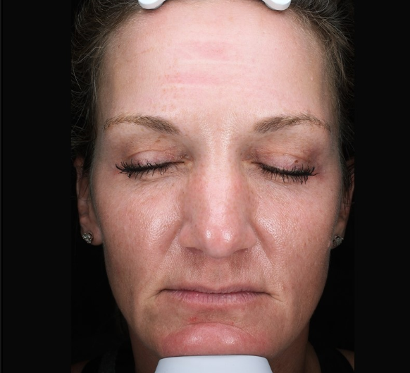 Patient 27 After Image