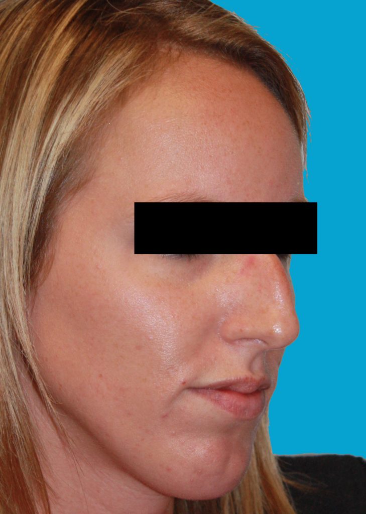 Patient 8 Before Image