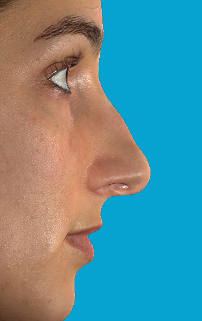 Patient 5 Before Image