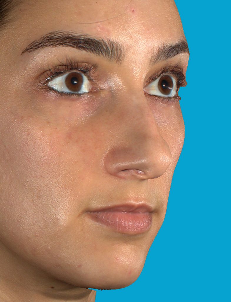 Patient 5 Before Image