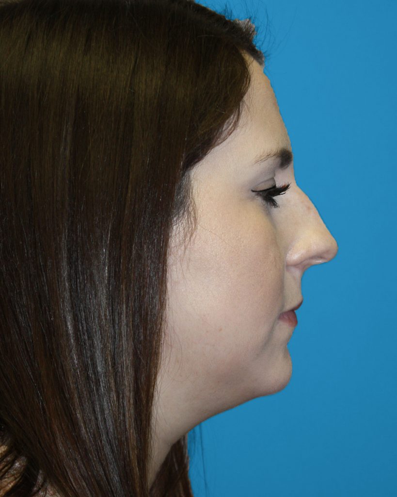 Patient 6 Before Image