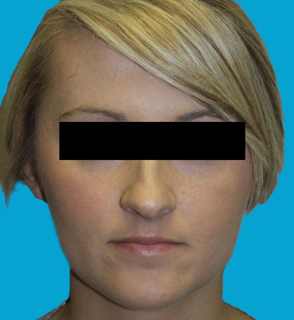 Patient 7 Before Image