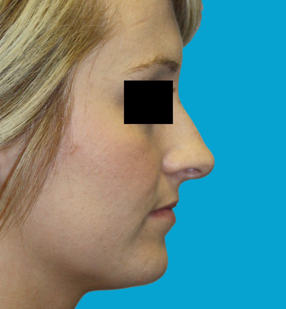 Patient 7 Before Image