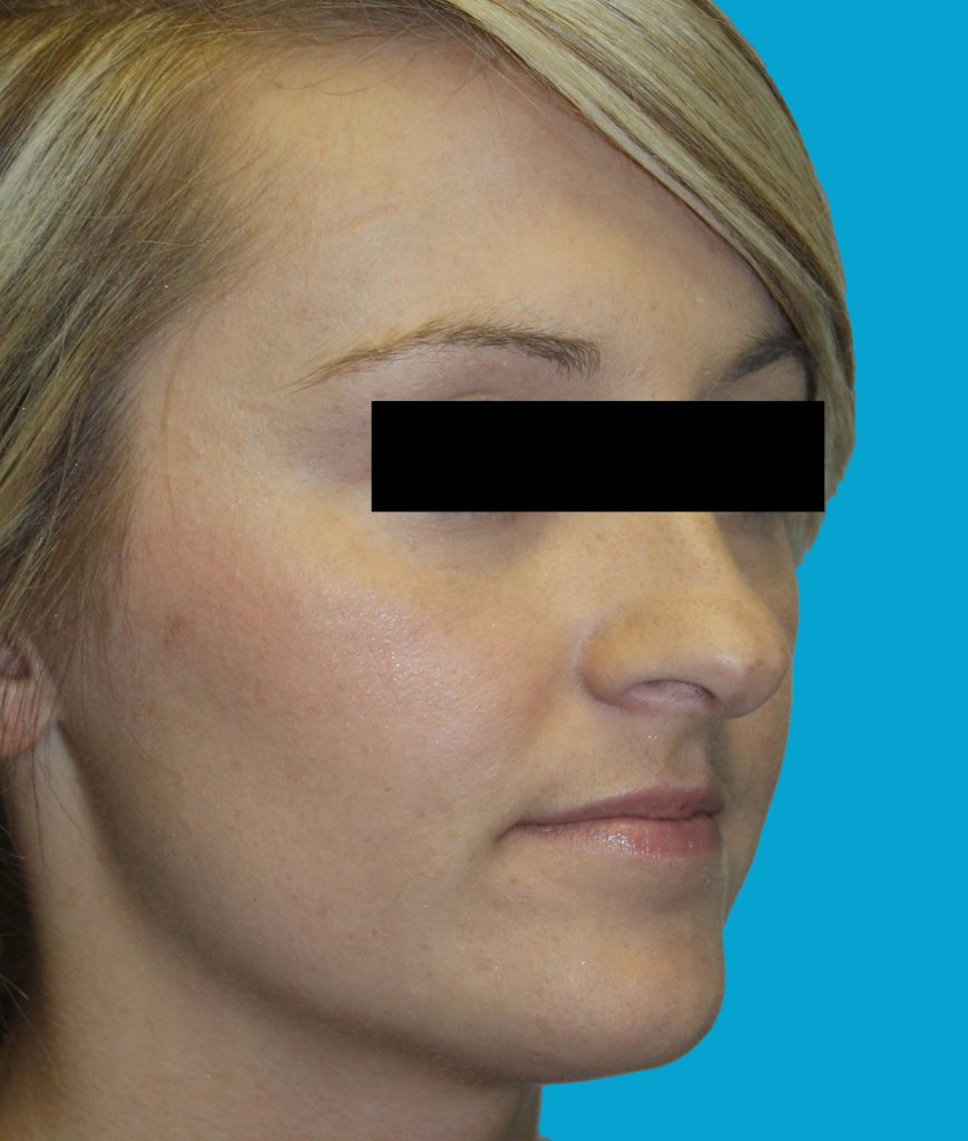 Patient 7 Before Image