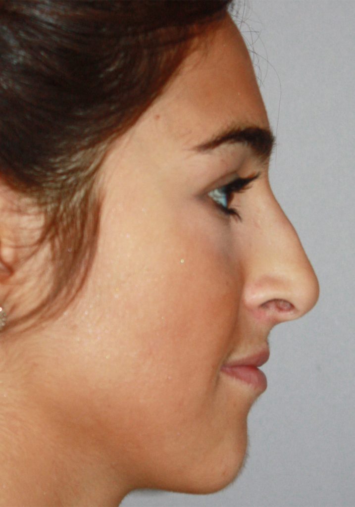 Patient 12 Before Image