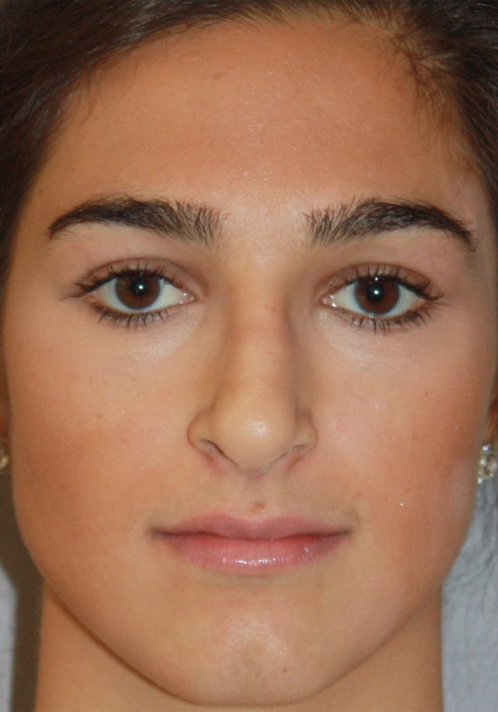 Patient 12 Before Image