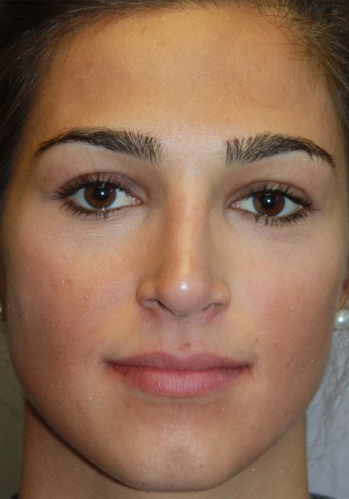 Patient 12 After Image