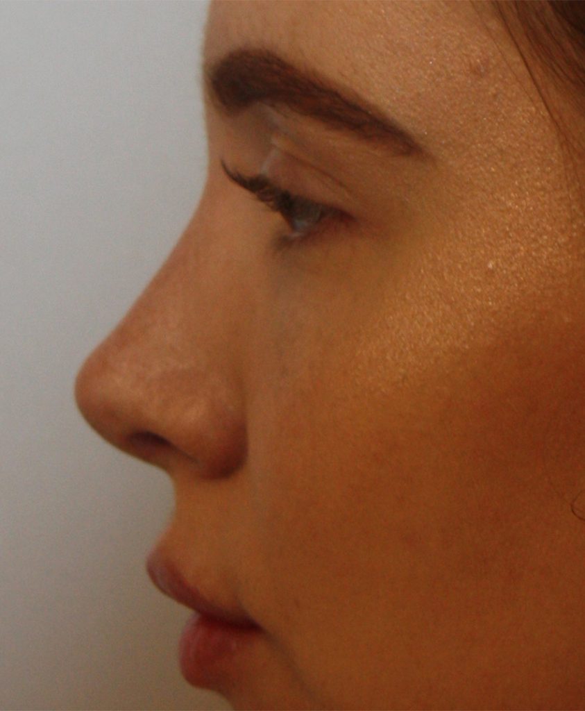 Patient 10 After Image