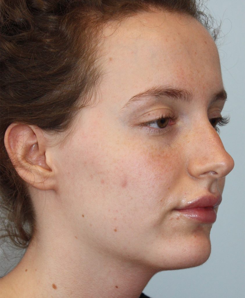 Patient 10 Before Image