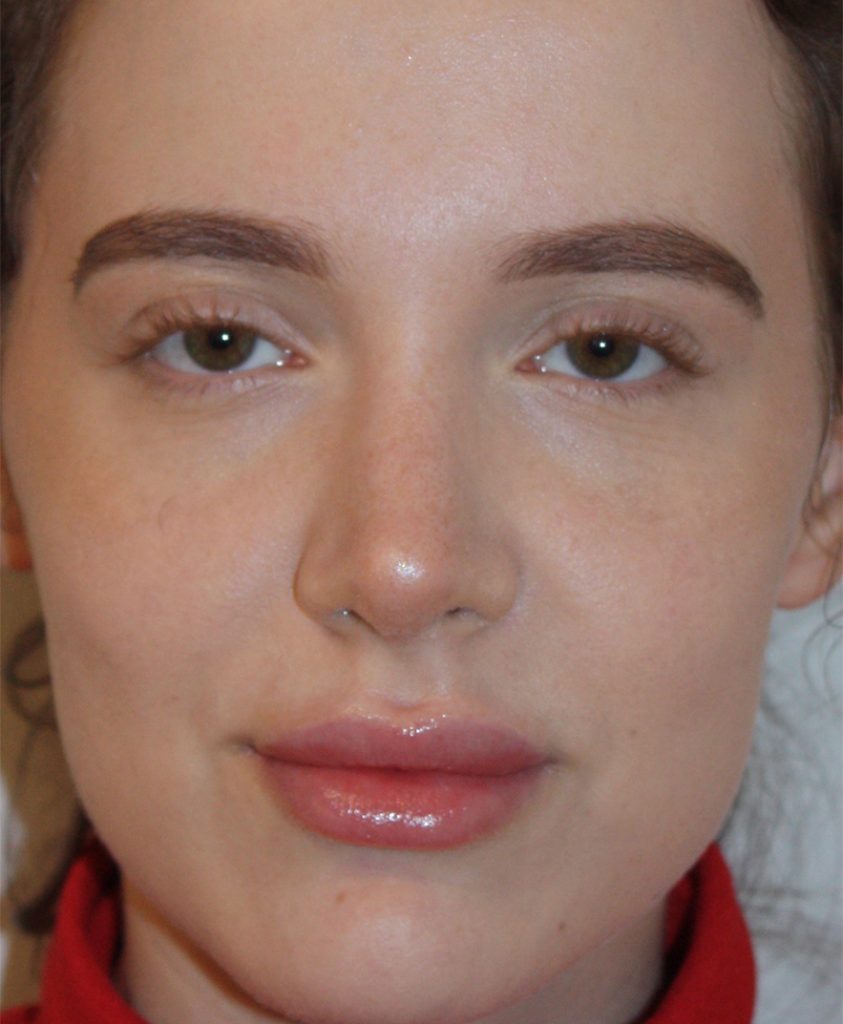 Patient 10 After Image