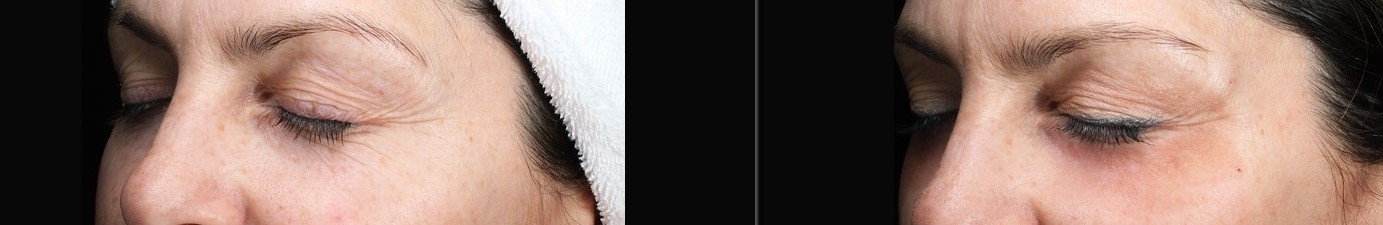 Patient #115 Marge Image