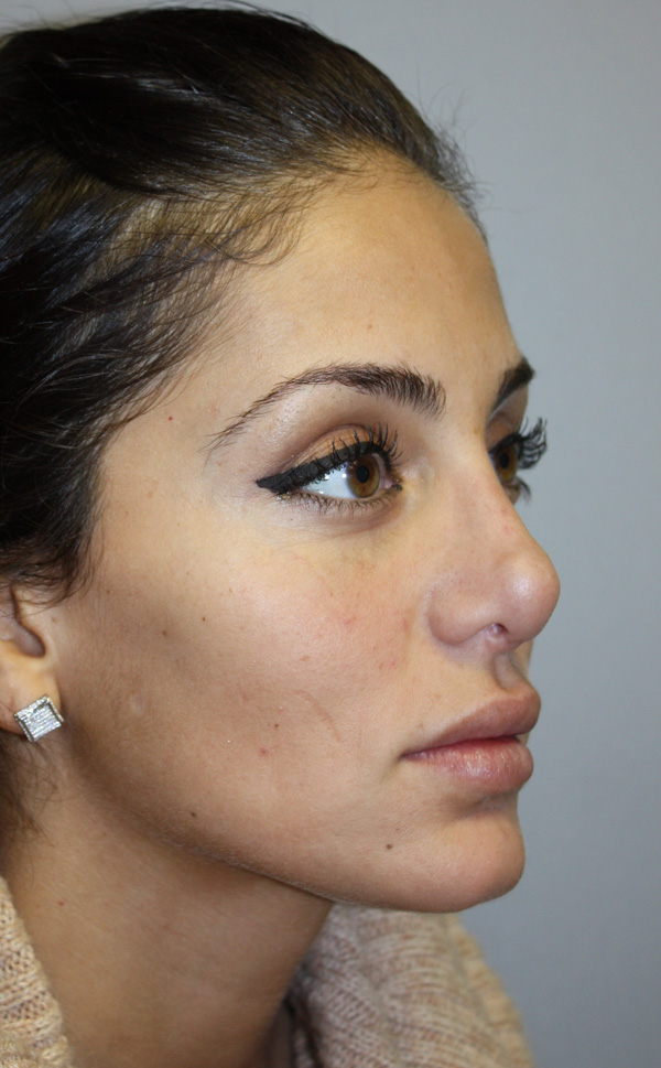 Patient 1 Before Image