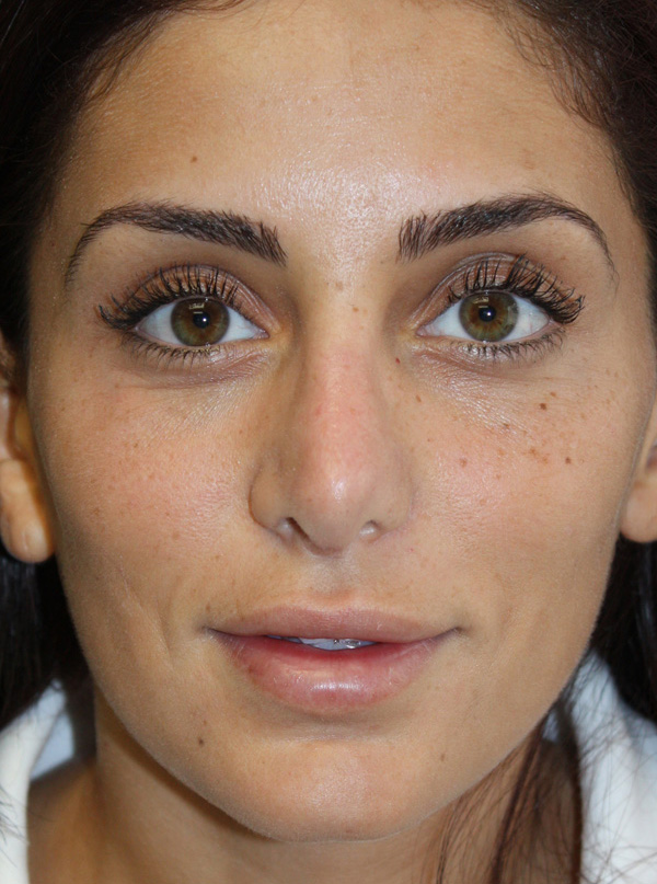 Patient 1 After Image