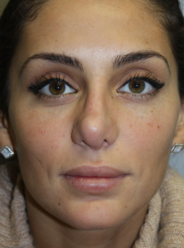 Patient 1 Before Image