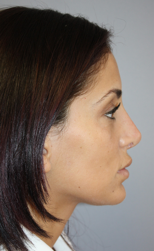 Patient 1 After Image