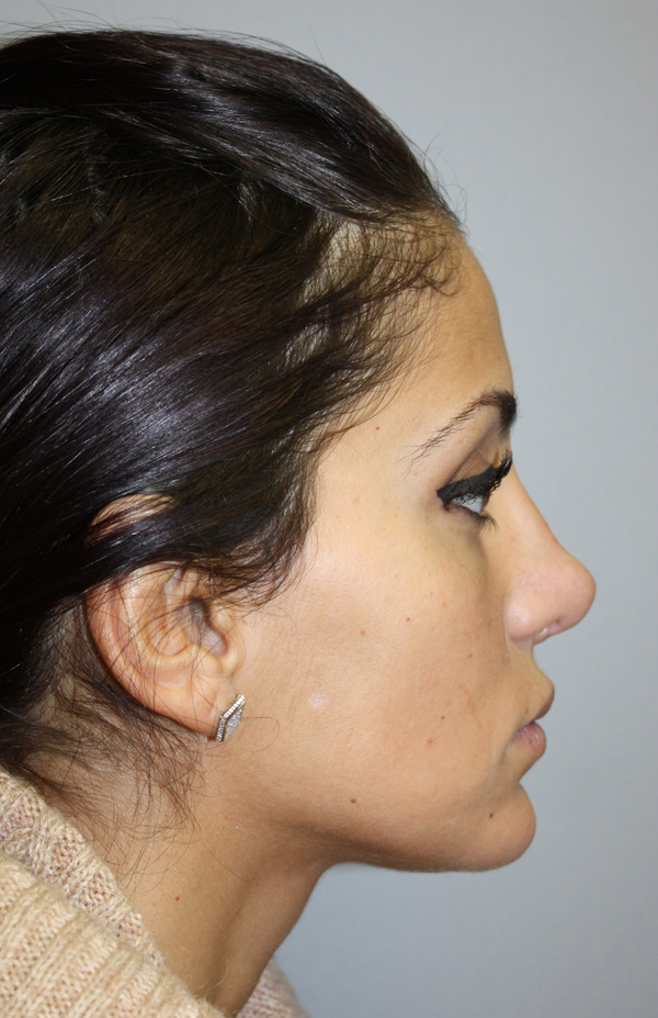 Patient 1 Before Image