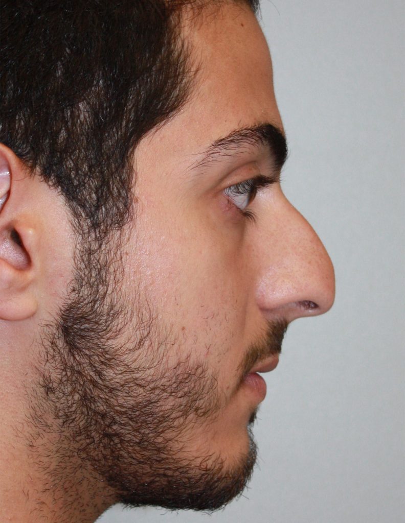 Patient 9 Before Image