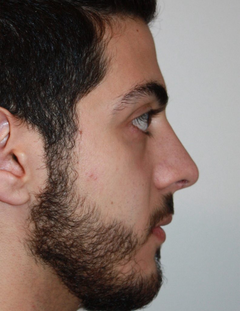 Patient 9 After Image