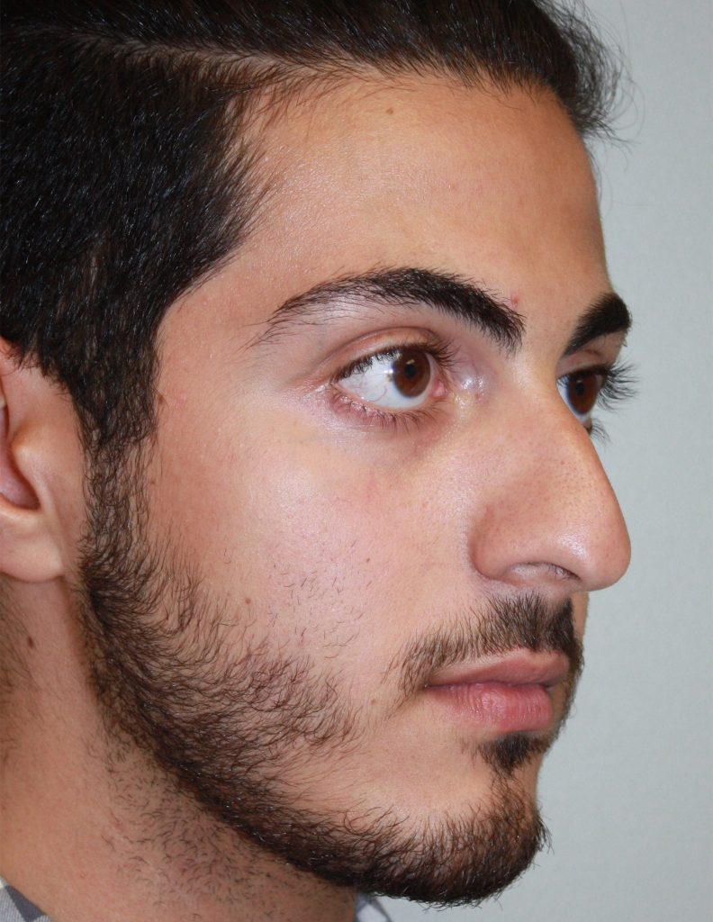 Patient 9 Before Image