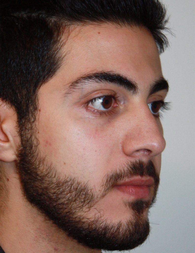 Patient 9 After Image