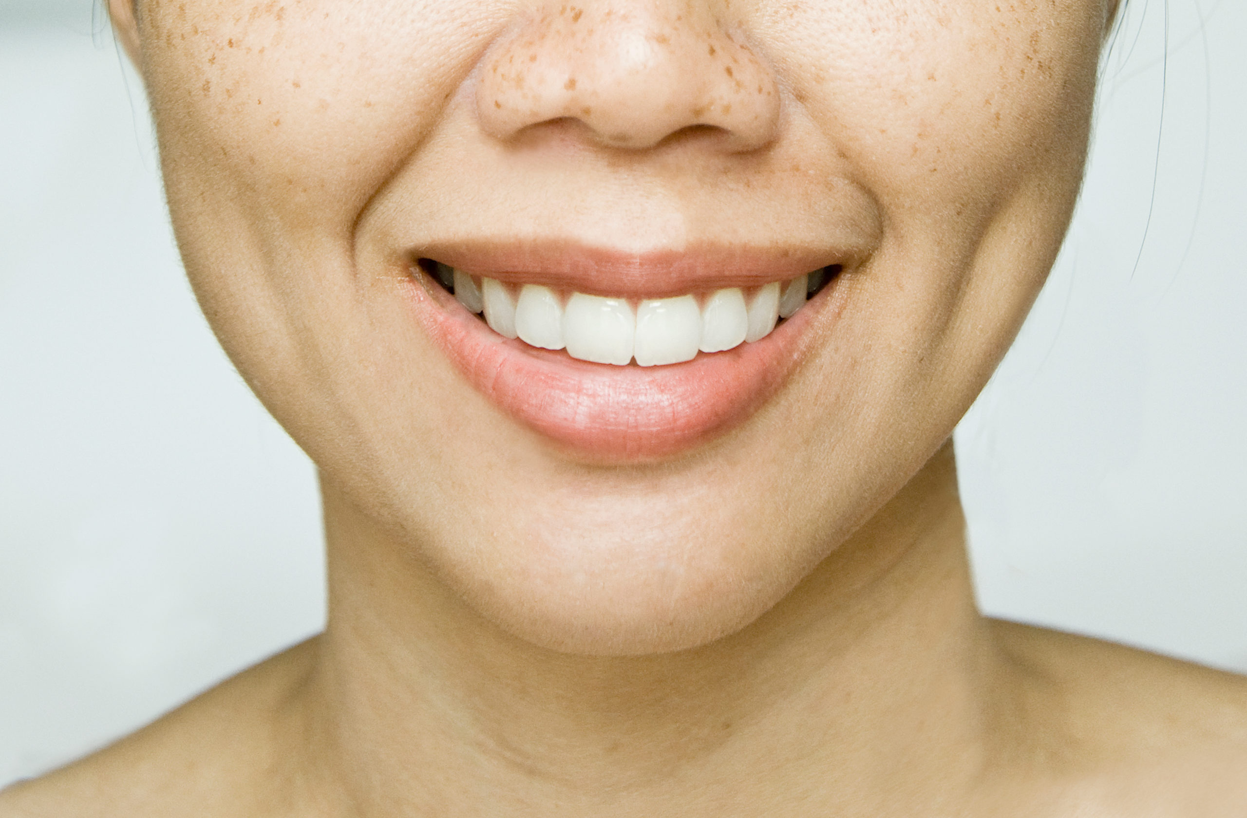 What is Dimpleplasty? Image