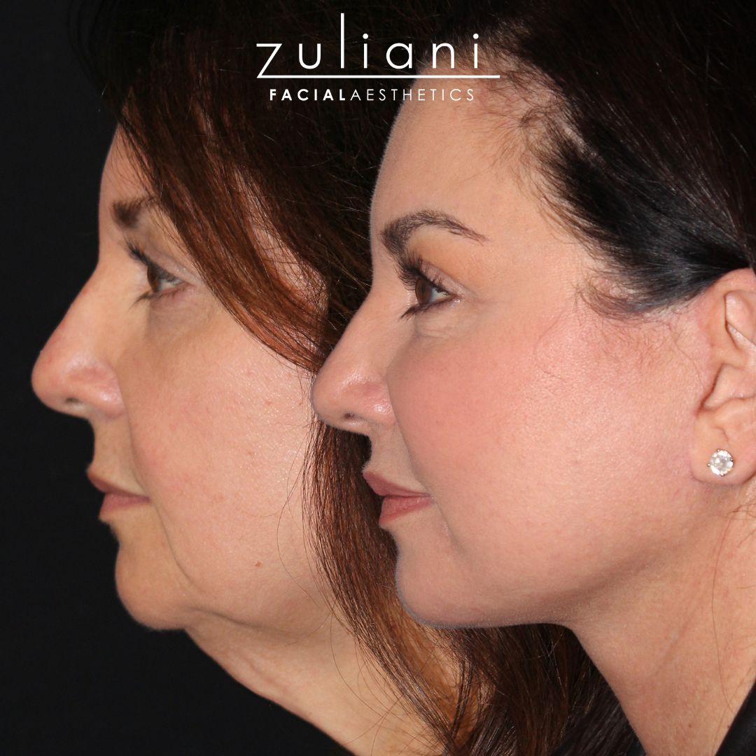 Patient #205 Marge Image