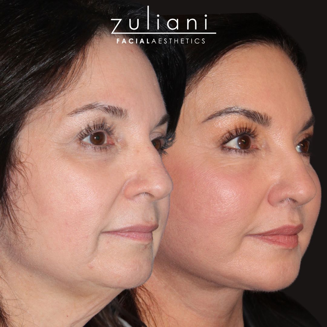 Patient #205 Marge Image