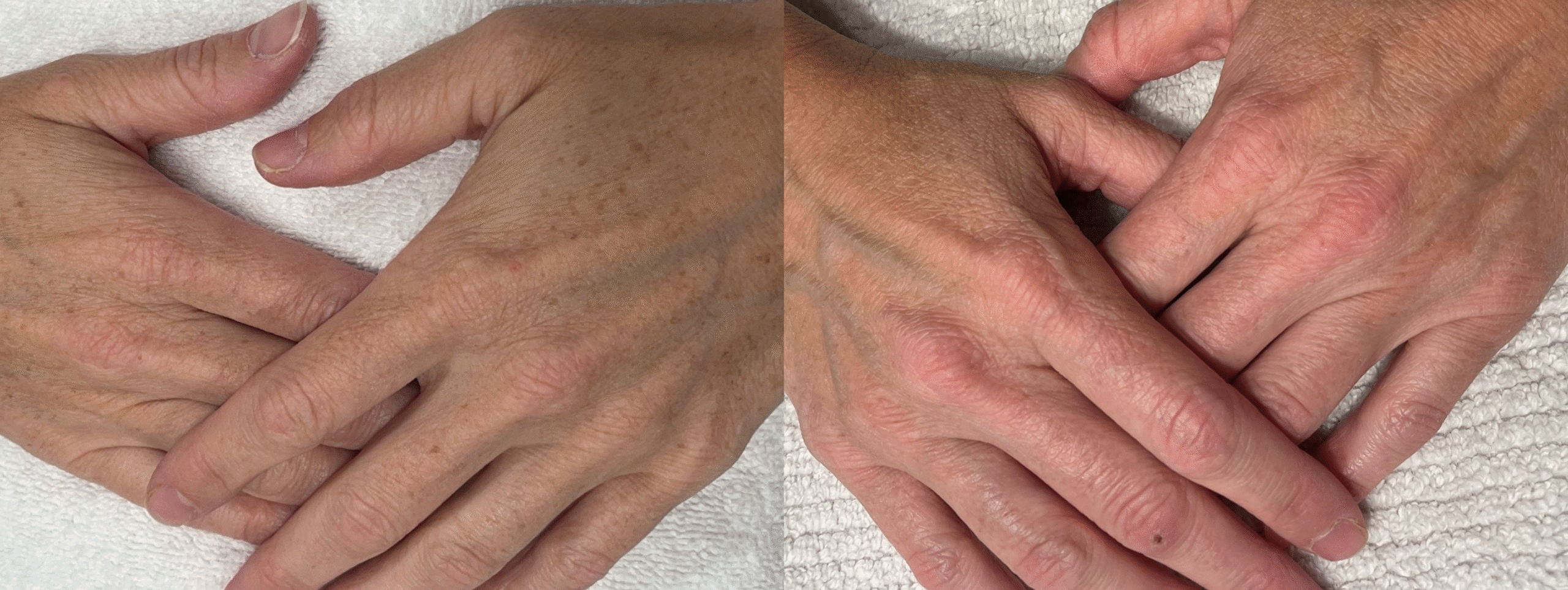 Patient #38 Marge Image