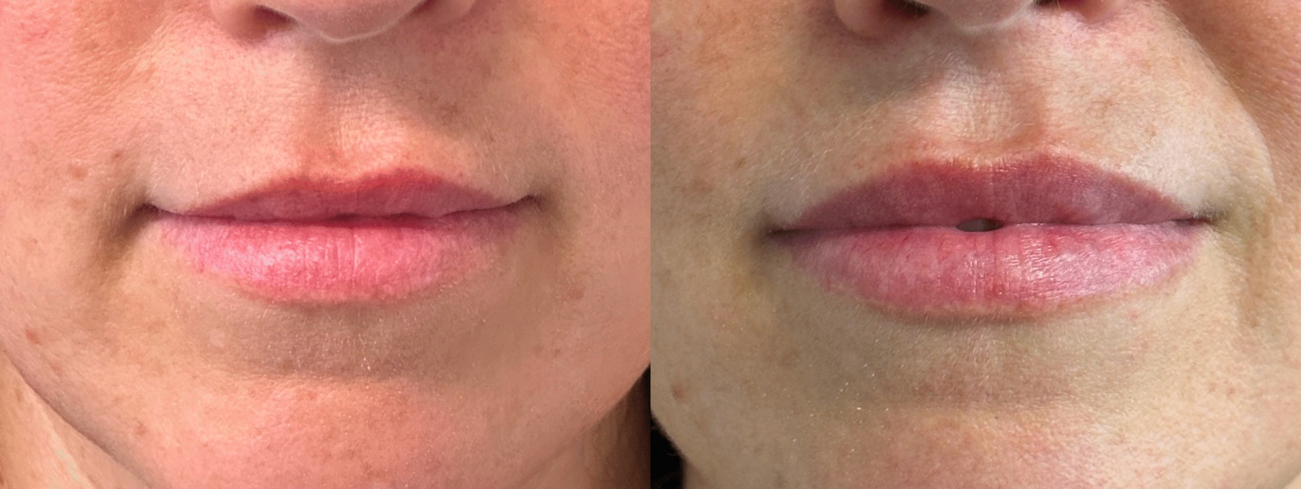 Patient 94 Marge Image