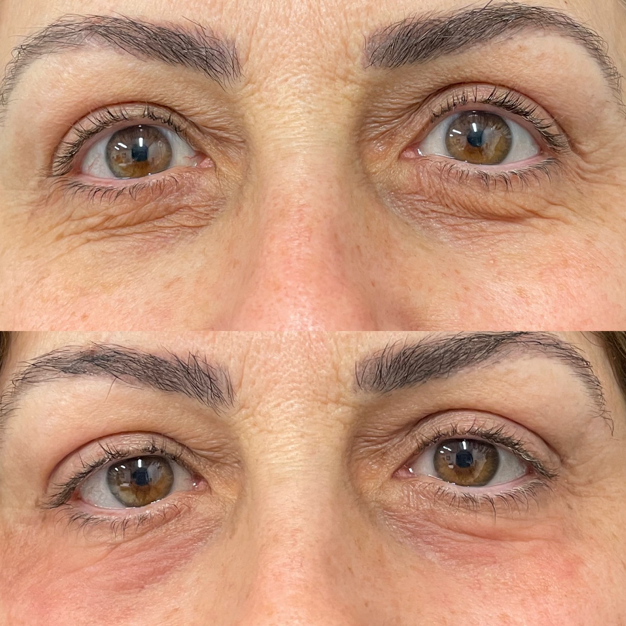 Patient #209 Marge Image