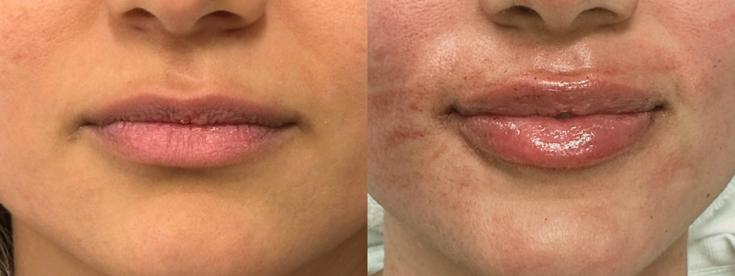 Patient #39 Marge Image